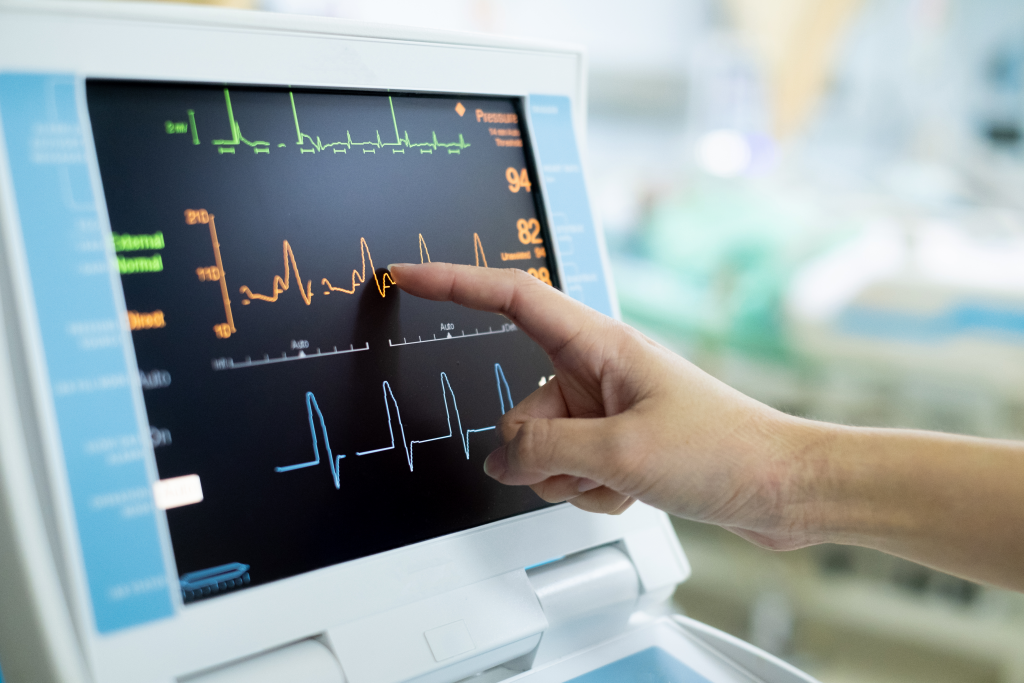 EKG monitor in intra aortic balloon pump machine. Medical equipment.